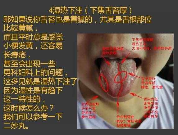 舌苔厚是什么原因的相关图片
