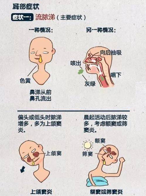 鼻屎是怎么形成的的相关图片